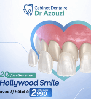 Facette dentaire prix Tunisie et offre promotionnelle