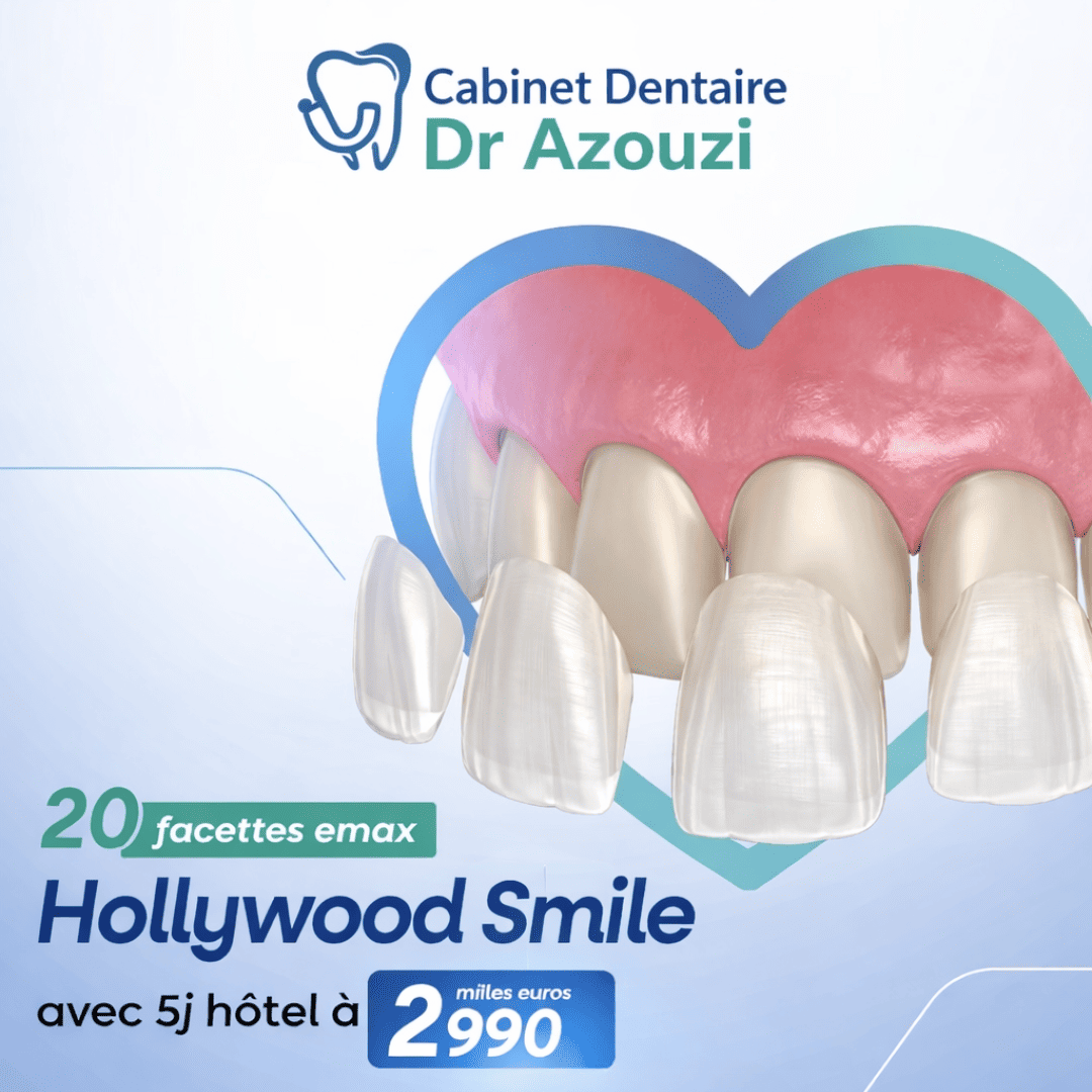 Facette dentaire prix Tunisie et offre promotionnelle